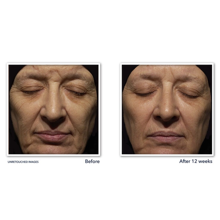 Roc Juego de Crema de Noche con Retinol — Imagen 2 de 4