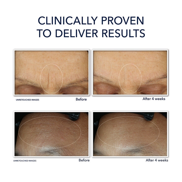 Roc Juego de Crema Hidratante con Retinol — Imagen 4 de 4