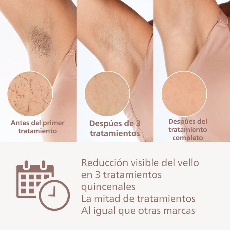 Philips Lumea Depiladora Series 8000 — Imagen 4 de 4