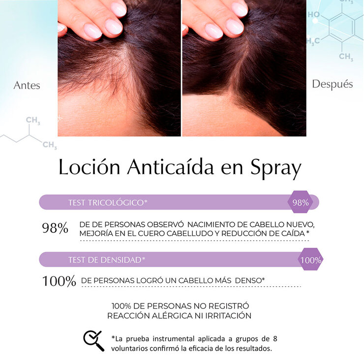 Marie D' Argan, Kit Anticaída Shampoo y Loción en Spray — Imagen 3 de 4